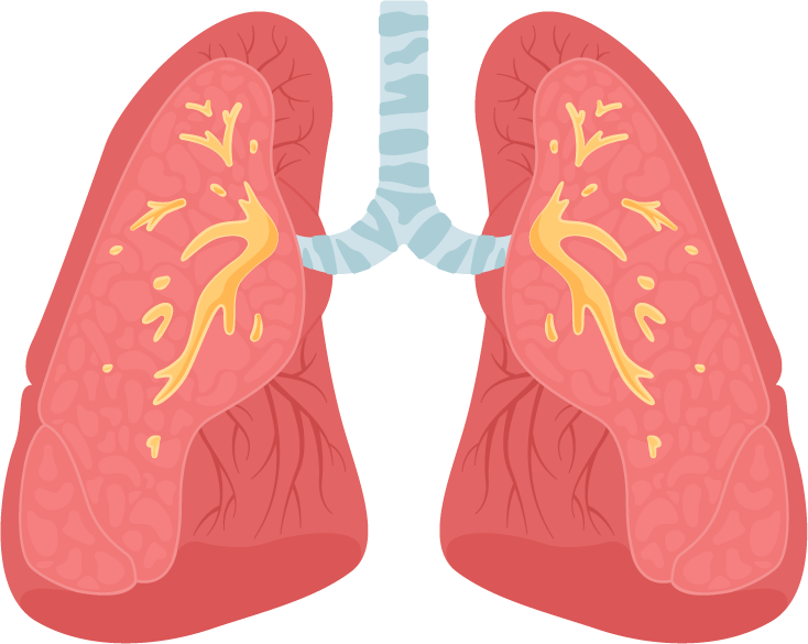 Respiratory Muscle Training THE BREATHER respiratory-muscle-training-the-breather